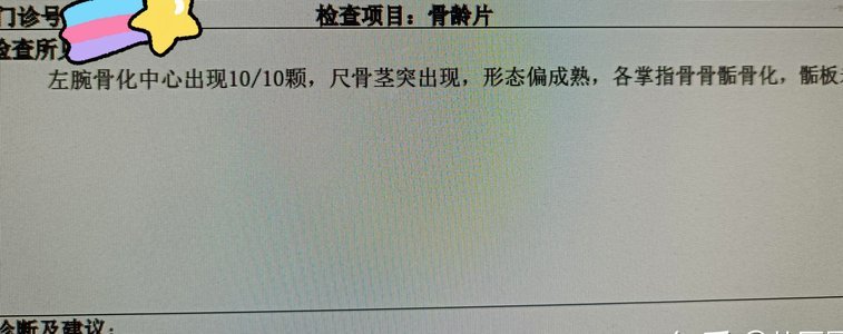 再说一句，早发育的你就早点跳级，不然就是耽误自己